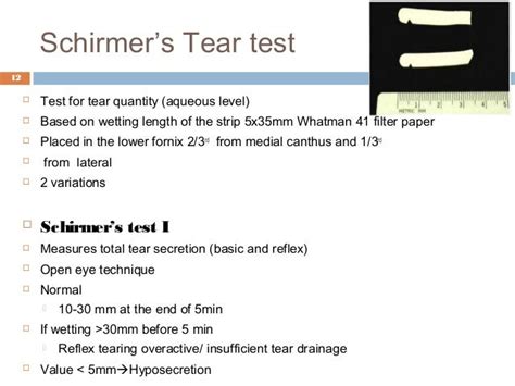 shermer tear test|schirmer's test normal value.